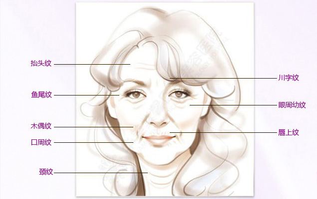 玻尿酸除皱_botox注射除皱_保妥适注射除皱_