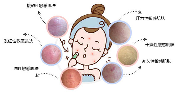 美莱敏感肌修复_宁波美莱整形医院